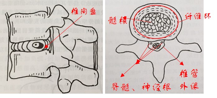 五张图带你了解椎间盘病理退变的奇妙过程