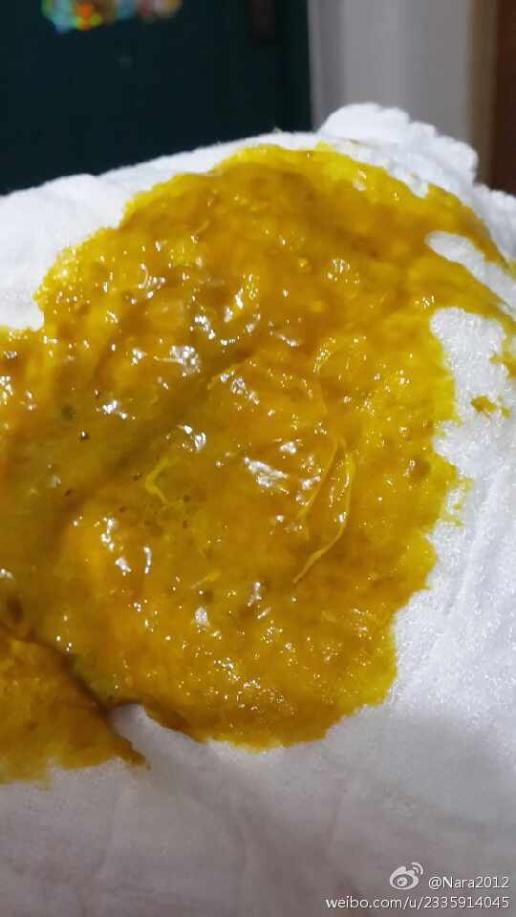 请问宝宝大便里有黄色奶瓣和黄色丝状东西是消