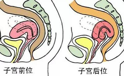 切除子宫的女人与其他女人有什么区别