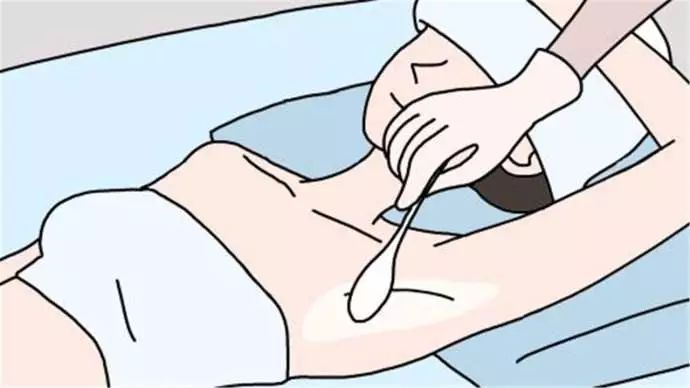腋臭非手术治疗的方式有用吗