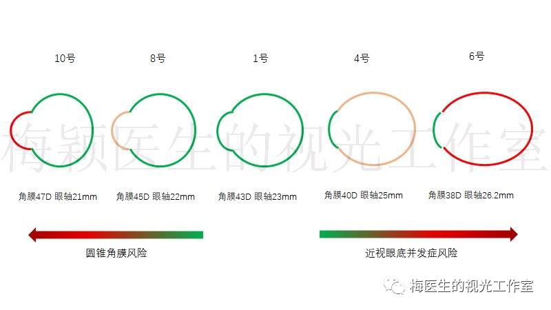 医生说孩子现在还没近视,但眼轴比同龄儿童长了,怎么办?