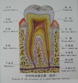 镶牙必看:镶牙前牙根应该怎么处理才合理?