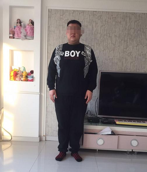 如今瘦了,黑棘皮病也不药而愈,脸上看起来也更白净了.