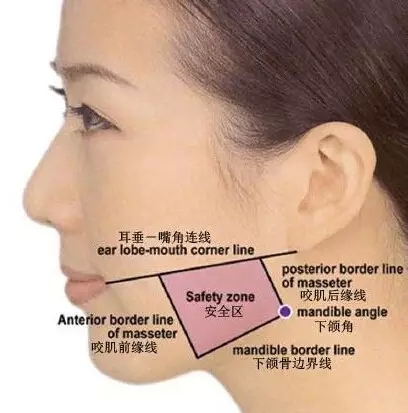 瘦脸针效果差?术后和哪些因素有关系!