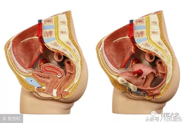 当我们人体在站立的时候,女性的盆腔内,尤其是子宫后方和直肠之间的