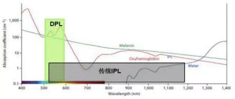 ipl 和 dpl 的波段对比