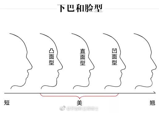 成人骨性前突告别手术,拔牙矫正加支抗钉美到你害怕