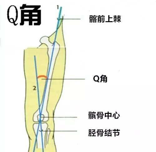 angle,是髂前上棘至髌骨中心连线与髌骨中心至胫骨结节连线的夹角