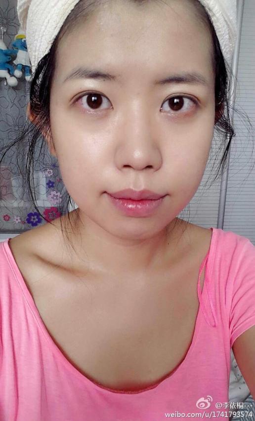 眼睛里的红血丝到底怎么去啊已经不敢戴隐形了[抓狂]