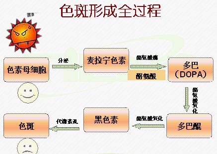 黑色素沉淀形成晒斑