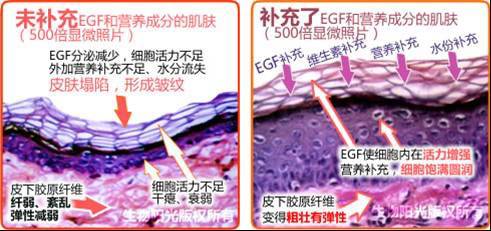 (左图)流失了营养成分的皮肤,细胞干瘪活力不足弹性很差,衰老(右图)