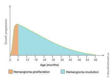 hemangioma_growth_graph_chart_img_en.jpg