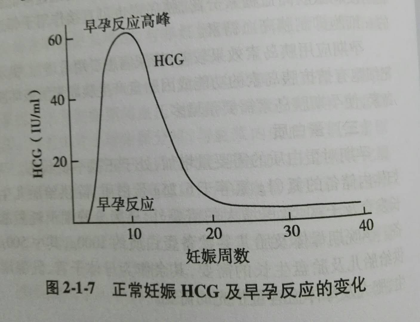 1,与"孕吐"相关性最大的生理原因是怀孕以后hcg水平升高,虽然hcg水平