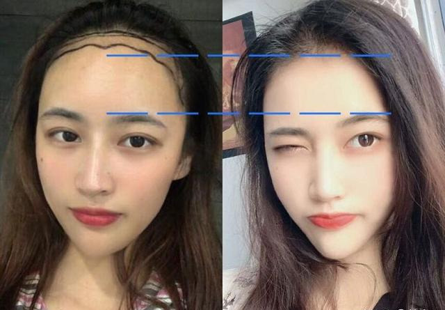 为什么整容一眼就能看出来?