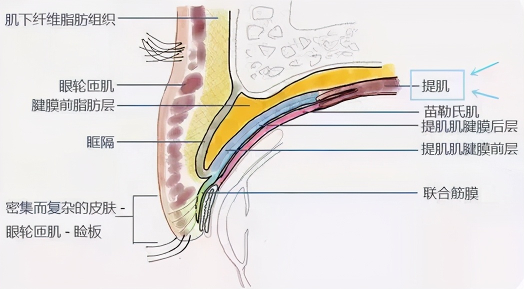 上睑下垂改善问题