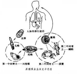 生食或半生食(如腌吃,醉吃或烤吃)被并殖吸虫囊蚴感染的淡水蟹或蝲蛄