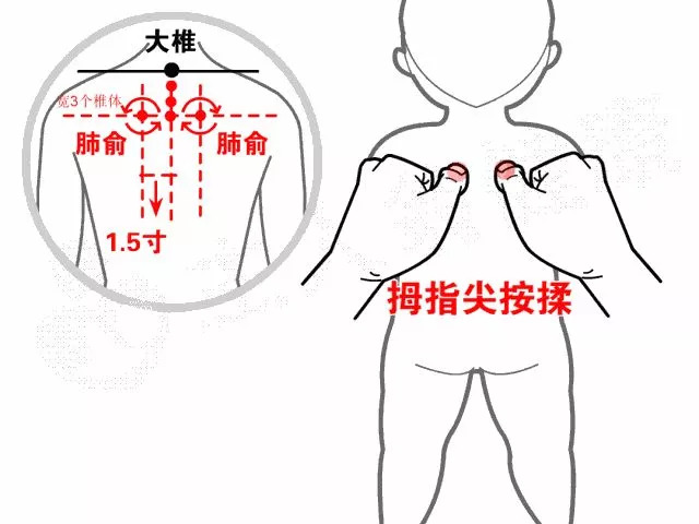 【小儿推拿】化痰止咳不用吃药,国医精髓让孩子不受罪