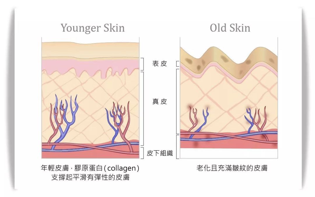 皮肤松弛下垂,下颚缘不清晰?用这一招解决