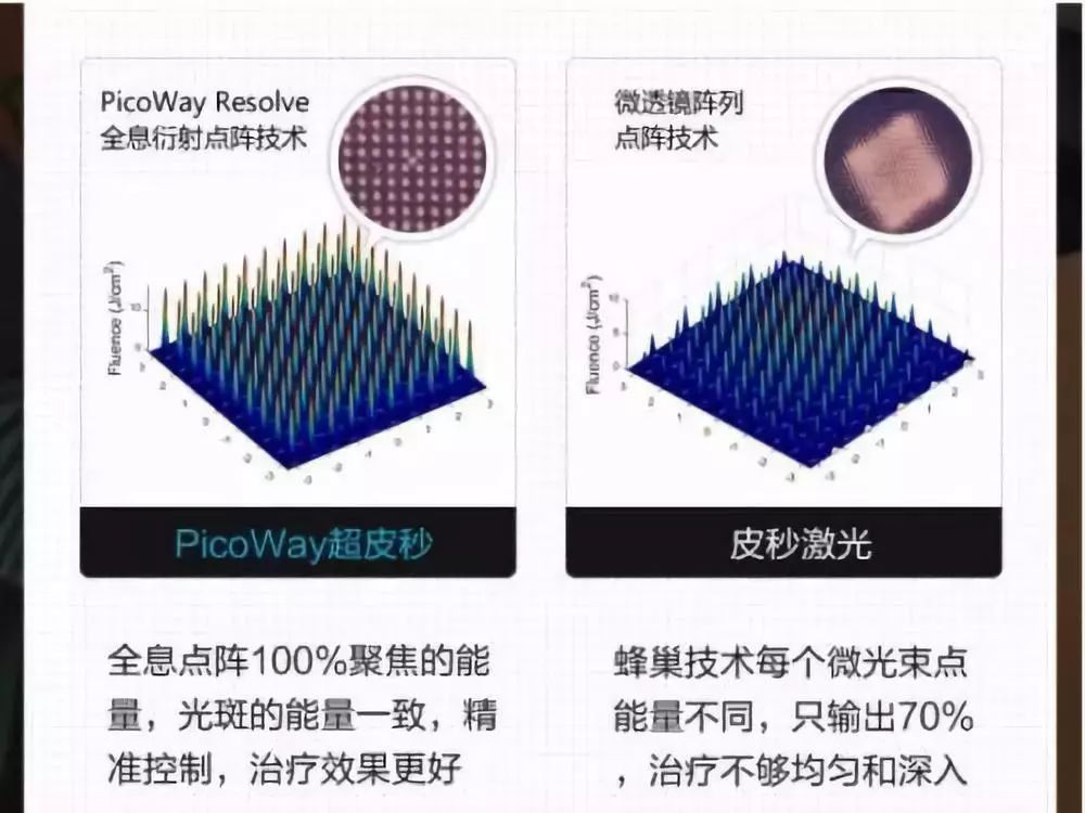 皮秒和超皮秒有什么区别?