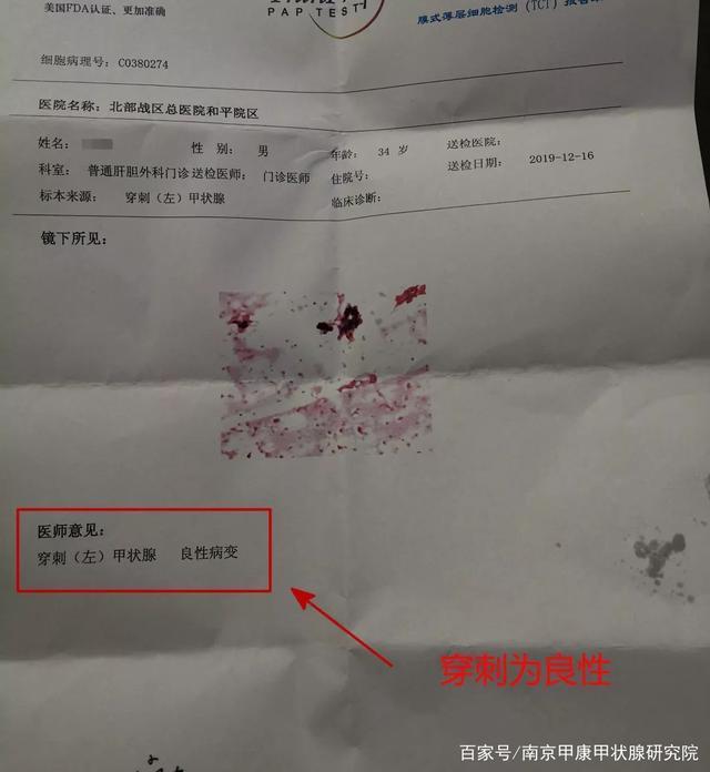 患者体检查出三类的甲状腺结节,穿刺过后十分纠结,该如何处理