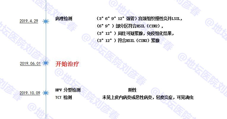 9°12°颈管)宫颈组织慢性炎,并lsil(6°9)部分区符合hsil(cin2)