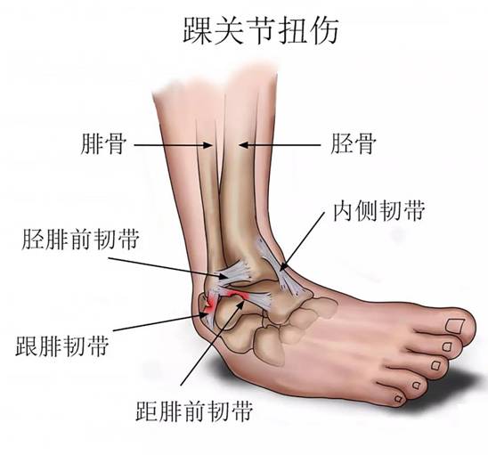 特别是腓骨在外侧脚踝的位置比在内侧脚踝的胫骨要低得多,所以当我们