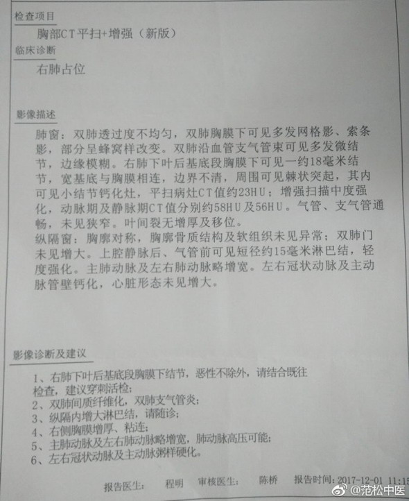 肺癌中晚期合并肺纤维化,治疗病例