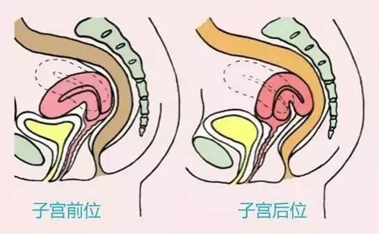 位指的是子宫颈是向下指向阴道后穹窿,子宫前位是女性子宫常见的位置