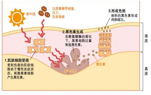 (色斑形成原因及过程,图片来源于网络)