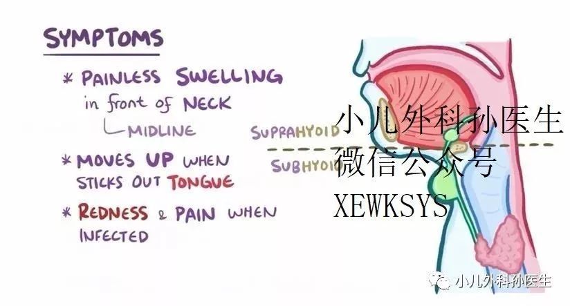 sun|小朋友长出了"喉结"?不,那可能是甲状舌管囊肿