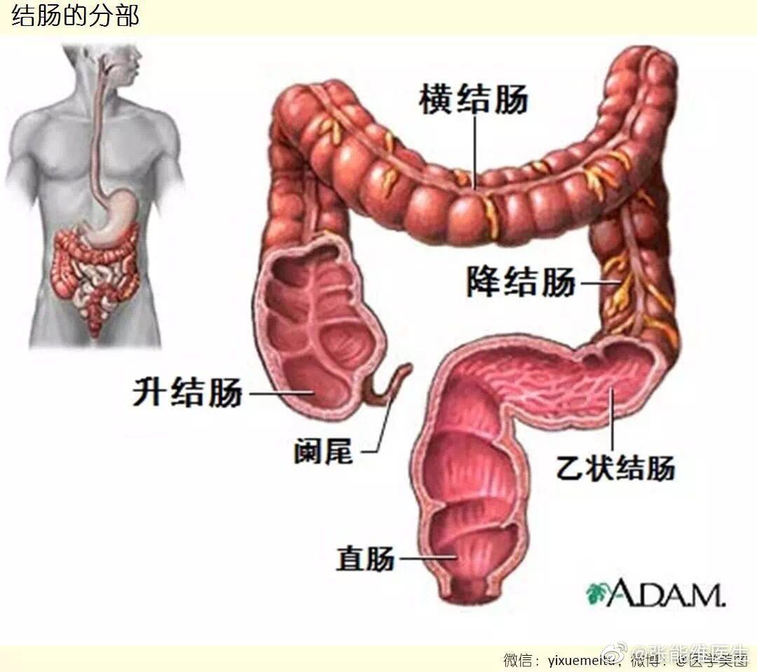 手术病例分享:81岁直肠癌乙状结肠癌患者免辅助切口根治术