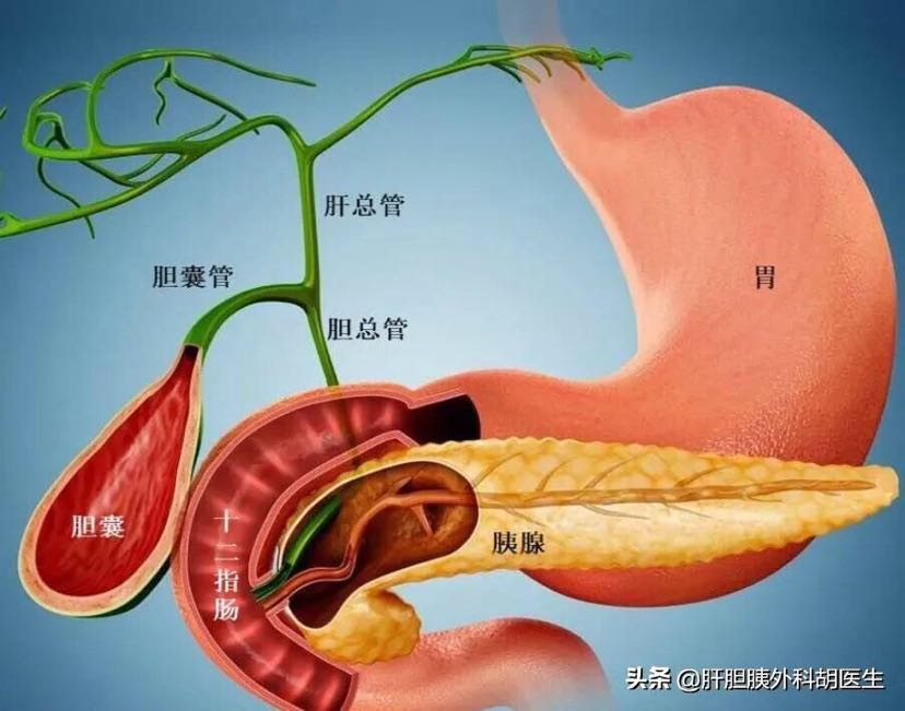 图2患者胆囊管正常位置汇入胆管.