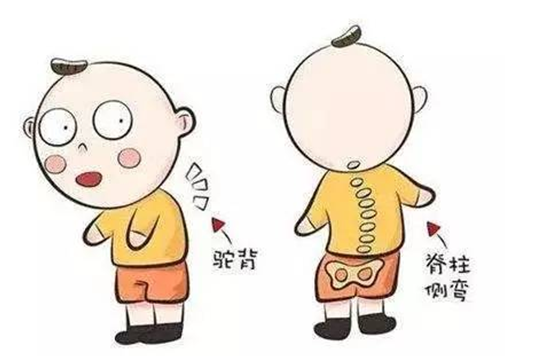 脑瘫患儿是否会出现脊柱后凸?