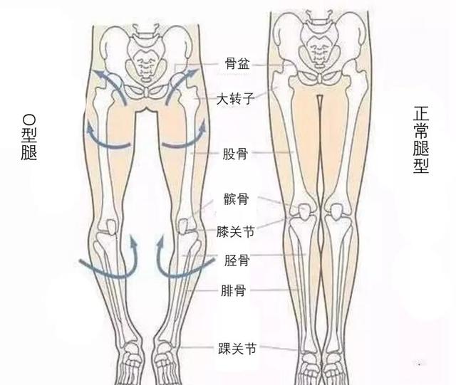 很多宝妈关心孩子o型腿与x型腿问题,其实有些担心是多余的