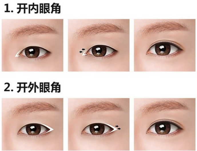 开眼角的风险大吗?