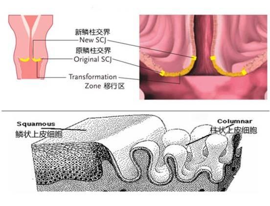 化生上皮与宫颈柱状上皮相连接,形成新的鳞柱交界.