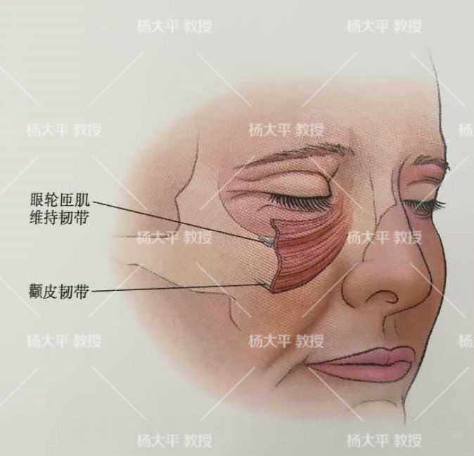 颧骨脂肪袋和两颊脂肪袋过于发达以及周围肌肉(颧小肌,颧大肌)的松弛