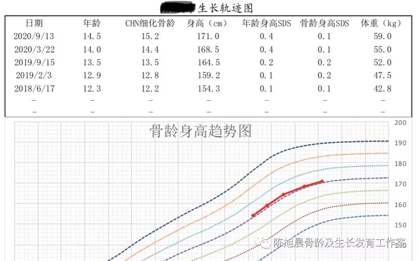 骨龄小知识,什么是骨龄,如何测骨龄