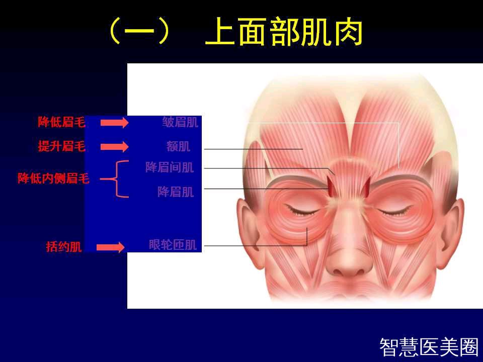 常见于面部表情丰富的年轻人,治疗方法:注射肉毒素抑制皱眉肌,降眉肌