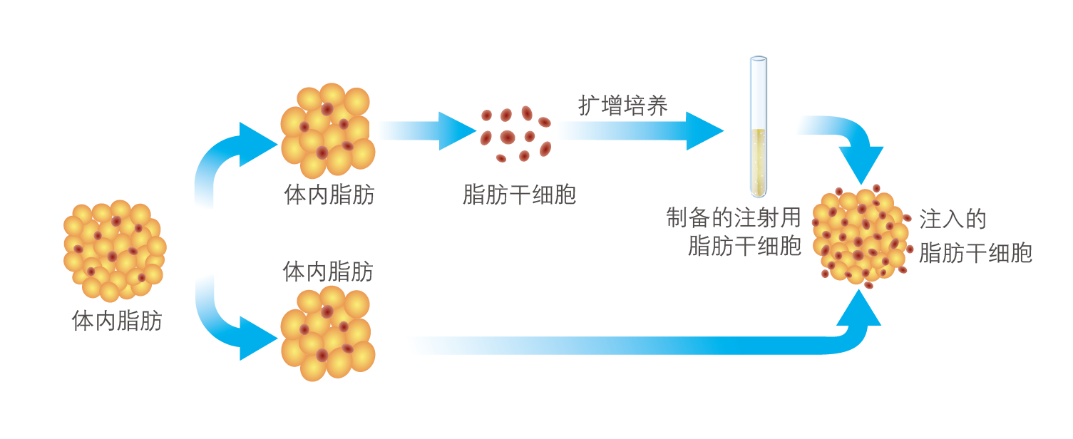 脂肪结构分型筛选