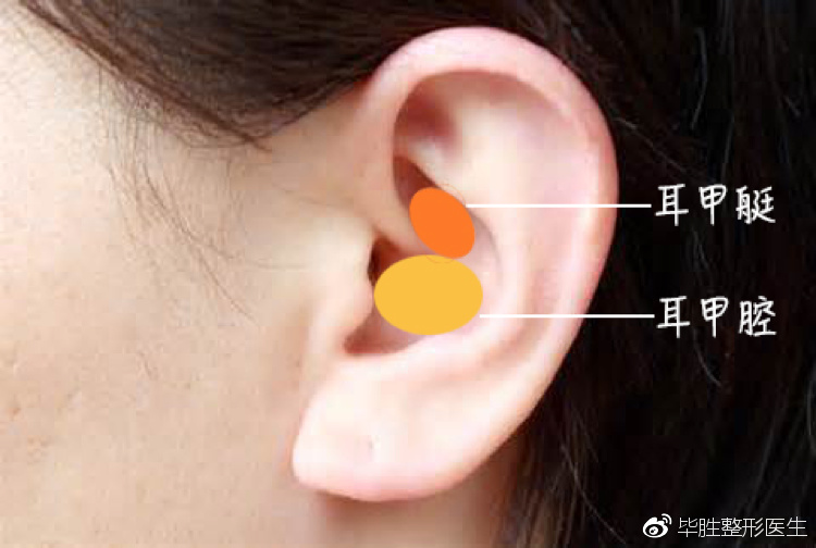 通常我们切取耳软骨的部位是在"耳窝,医学上称为耳甲腔和耳甲艇.