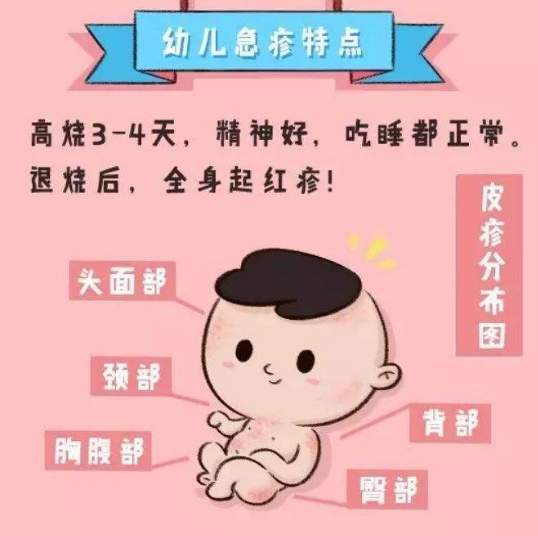 孩子生后第一次发热,很大可能是幼儿急疹(出疹子)