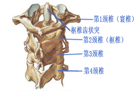 寰枢关节脱位或称为寰,枢椎脱位,是指颈椎的第一节(寰椎,第二节(枢椎