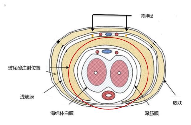 要回答这个问题,首先我们有必要了解一下玻尿酸的填充位