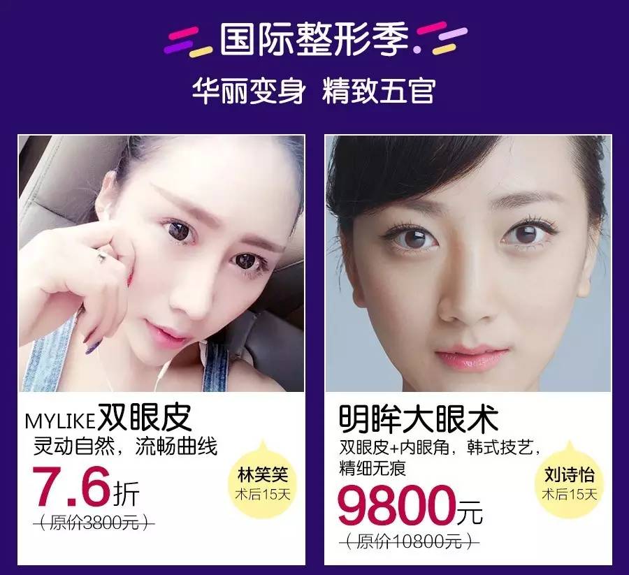 做了双眼皮后,竟成了表情包