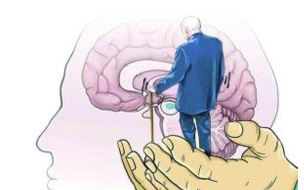 帕金森病患者为什么要坚持记日记