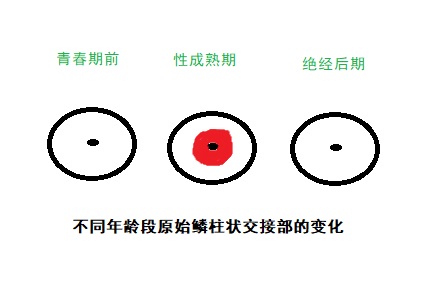 3型转化区严重吗?