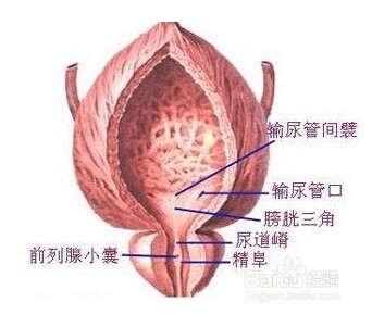 膀胱癌亲睐高龄男性