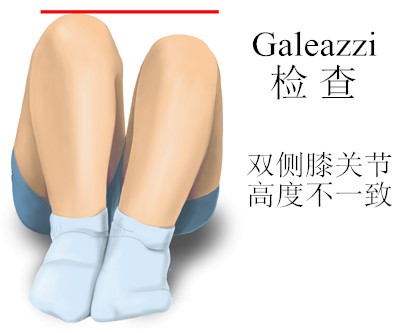 手把手教新生妈妈们怎么检查宝宝的髋关节