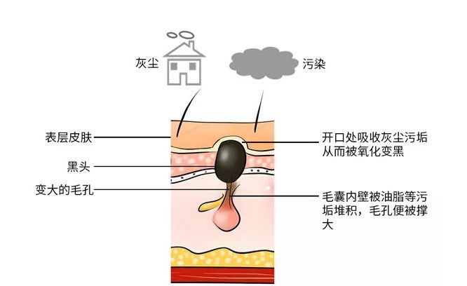 黑头降魔篇